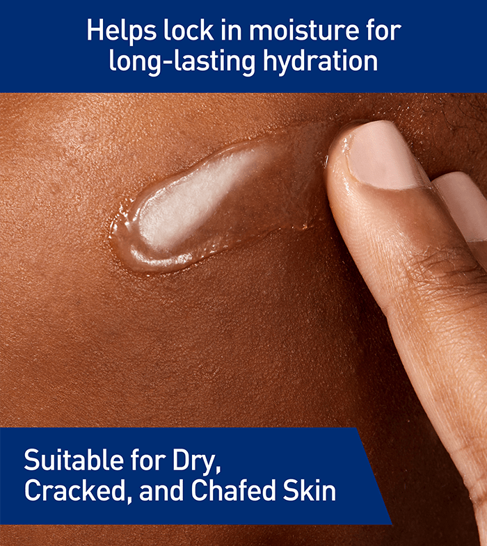 healing-ointment_700x785_helps-lock-in-moisture_v1.png